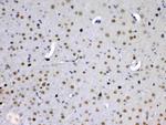 PCQAP Antibody in Immunohistochemistry (Paraffin) (IHC (P))