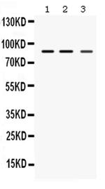 MEFV Antibody in Western Blot (WB)