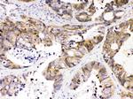 NDRG3 Antibody in Immunohistochemistry (Paraffin) (IHC (P))