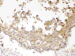 NDRG3 Antibody in Immunohistochemistry (Paraffin) (IHC (P))