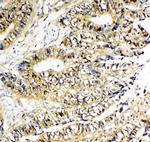 NME2 Antibody in Immunohistochemistry (Paraffin) (IHC (P))