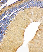 NME2 Antibody in Immunohistochemistry (Paraffin) (IHC (P))