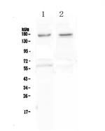 NRXN1 Antibody in Western Blot (WB)