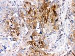 DARPP-32 Antibody in Immunohistochemistry (Paraffin) (IHC (P))