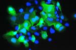 S100A7 Antibody in Immunocytochemistry (ICC/IF)