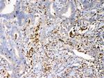 S100A7 Antibody in Immunohistochemistry (Paraffin) (IHC (P))