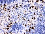 S100A8 Antibody in Immunohistochemistry (Paraffin) (IHC (P))