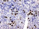 S100A8 Antibody in Immunohistochemistry (Paraffin) (IHC (P))