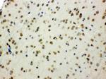 SHC Antibody in Immunohistochemistry (Paraffin) (IHC (P))