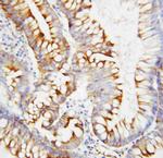 SPARC Antibody in Immunohistochemistry (Paraffin) (IHC (P))