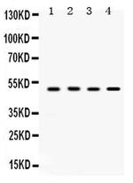 SULT2B1 Antibody in Western Blot (WB)