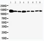 Vinculin Antibody in Western Blot (WB)