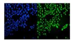 VCP Antibody in Immunocytochemistry (ICC/IF)