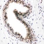 VCP Antibody in Immunohistochemistry (Paraffin) (IHC (P))