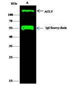 ATP Citrate Lyase Antibody in Immunoprecipitation (IP)