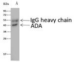 Adenosine Deaminase Antibody in Immunoprecipitation (IP)