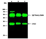 Cathepsin D Antibody in Immunoprecipitation (IP)