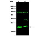 XTP3TPA Antibody in Western Blot (WB)