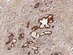 RCAS1 Antibody in Immunohistochemistry (Paraffin) (IHC (P))