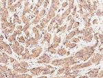 ErbB3 Antibody in Immunohistochemistry (Paraffin) (IHC (P))