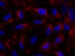 FceR1 alpha Antibody in Immunocytochemistry (ICC/IF)