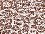 NBL1 Antibody in Immunohistochemistry (Paraffin) (IHC (P))