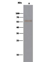 ST6GAL1 Antibody in Immunoprecipitation (IP)