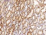 LYK5 Antibody in Immunohistochemistry (Paraffin) (IHC (P))