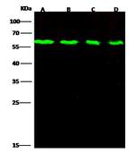 DR6 Antibody in Western Blot (WB)