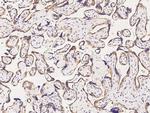 CCDC6 Antibody in Immunohistochemistry (Paraffin) (IHC (P))