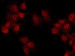 PBX1 Antibody in Immunocytochemistry (ICC/IF)