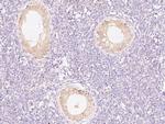 PIK3R2 Antibody in Immunohistochemistry (Paraffin) (IHC (P))