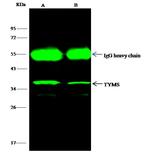 Thymidylate Synthase Antibody in Immunoprecipitation (IP)