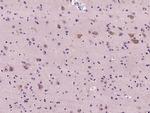 Neuropilin 1 Antibody in Immunohistochemistry (Paraffin) (IHC (P))