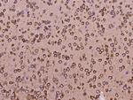 Neuropilin 1 Antibody in Immunohistochemistry (Paraffin) (IHC (P))