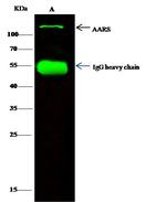 alanyl-tRNA Synthetase Antibody in Immunoprecipitation (IP)