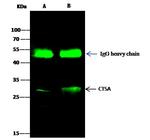 Cathepsin A Antibody in Immunoprecipitation (IP)