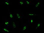 CD178 Antibody in Immunocytochemistry (ICC/IF)