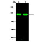 PKN1 Antibody in Western Blot (WB)