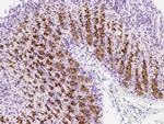 mGluR1 Antibody in Immunohistochemistry (Paraffin) (IHC (P))