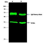 PCNA Antibody in Immunoprecipitation (IP)