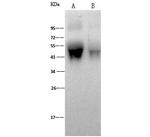 Influenza A H1N1 HA1 (A/WSN/33) Antibody in Western Blot (WB)