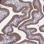 GRASP1 Antibody in Immunohistochemistry (Paraffin) (IHC (P))