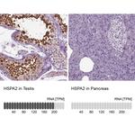 HSPA2 Antibody in Immunohistochemistry (Paraffin) (IHC (P))