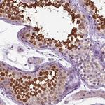 HSPA2 Antibody in Immunohistochemistry (Paraffin) (IHC (P))