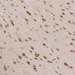 IKK alpha Antibody in Immunohistochemistry (Paraffin) (IHC (P))