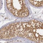 IKK alpha Antibody in Immunohistochemistry (Paraffin) (IHC (P))