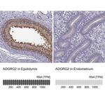 GPR64 Antibody