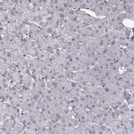 GPR64 Antibody in Immunohistochemistry (Paraffin) (IHC (P))