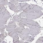 GPR64 Antibody in Immunohistochemistry (Paraffin) (IHC (P))